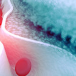 The Keto Diet and Cholesterol