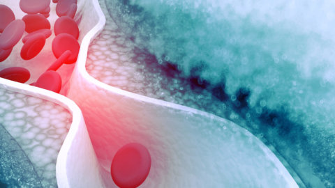 The Keto Diet and Cholesterol