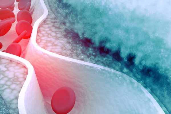 The Keto Diet and Cholesterol