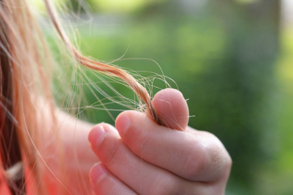 The Keto Diet and Hair Loss