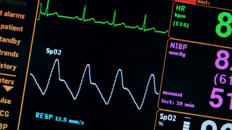 The Keto Diet & Heart Palpitations