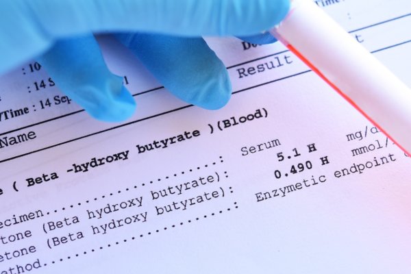 Ketosis vs. Ketoacidosis