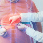 Fatty Liver