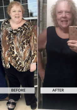 Lisa Summers Before and After