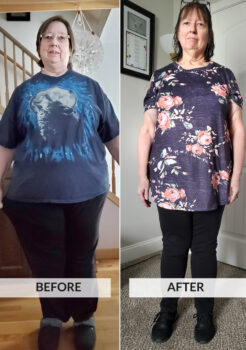 Before and After Photo
