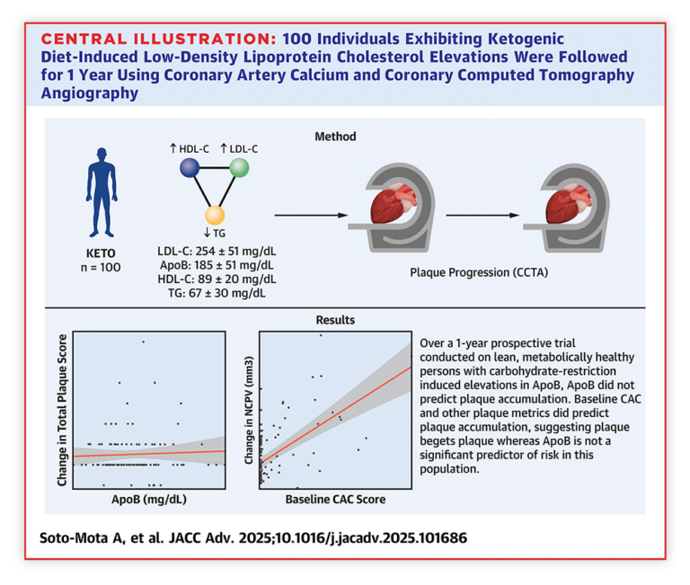 One hundred individuals exhibiting KD-induced LDL-C ≥190 mg/dL, high-density lipoprotein cholesterol ≥60 mg/dL, and triglycerides ≤80 mg/dL were followed for 1 year using coronary artery calcium